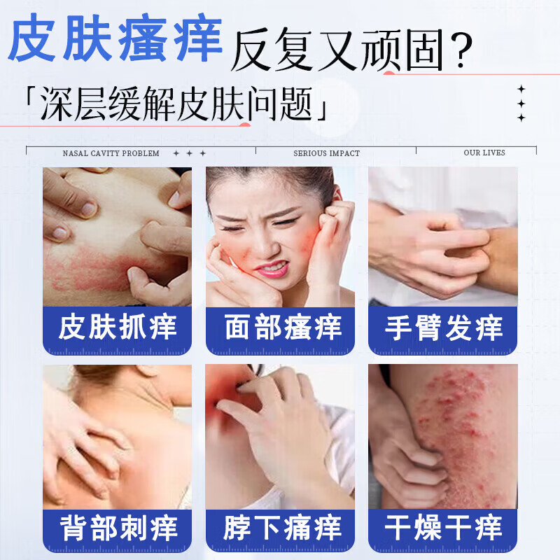 【日本炉甘石】特效皮肤瘙痒止痒乳膏全身体适用无激素天然草本膏 买7送8【季度装】常年痒