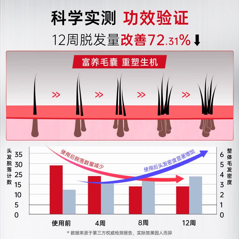 积菊【入会立减70】卡蓓诺防脱洗发水固发密发控油蓬松侧柏医用 【超市同款 持证防脱】卡蓓诺强韧防脱洗发水