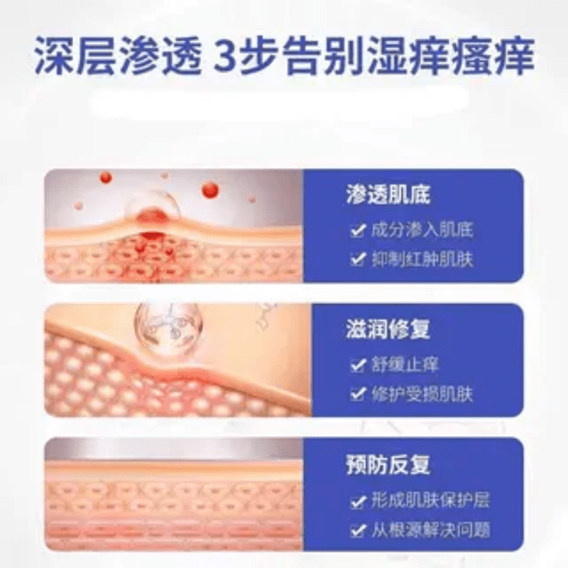 MRYU皮炎宁酊水正品外用皮肤膏止痒内蒙古大唐抑菌液脚蜕皮痒足部灵丁 3瓶【周期装】 官方直售