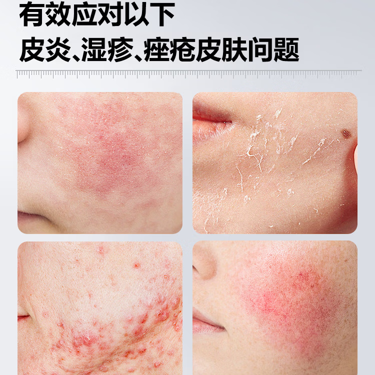 清沐妍QINGMUYAN医用III型皮炎、湿疹、痤疮修护凝胶  胶原蛋白修复   20ML