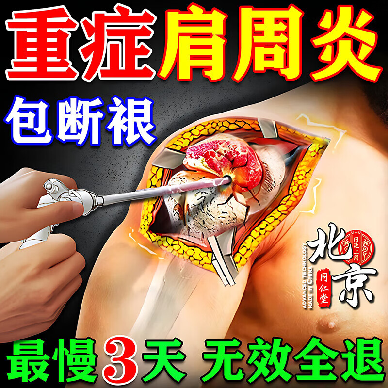 同仁堂肩周炎贴膏肩膀疼痛肩周劳损抬不起胳膊僵硬抬臂困难专用热敷药贴 1盒装[多买多送]
