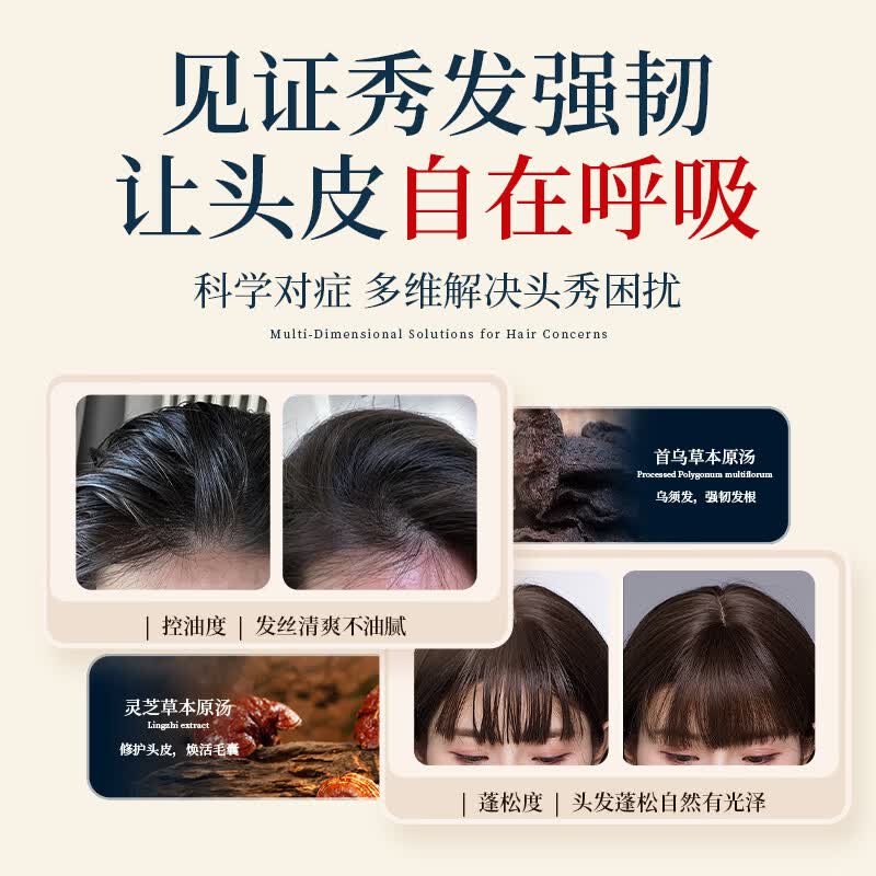 苗初源苗方天然植物草本原浆洗发膏去屑控油蓬松中草药洗发水强韧养发 【改善稀疏】洗发膏1代300ml