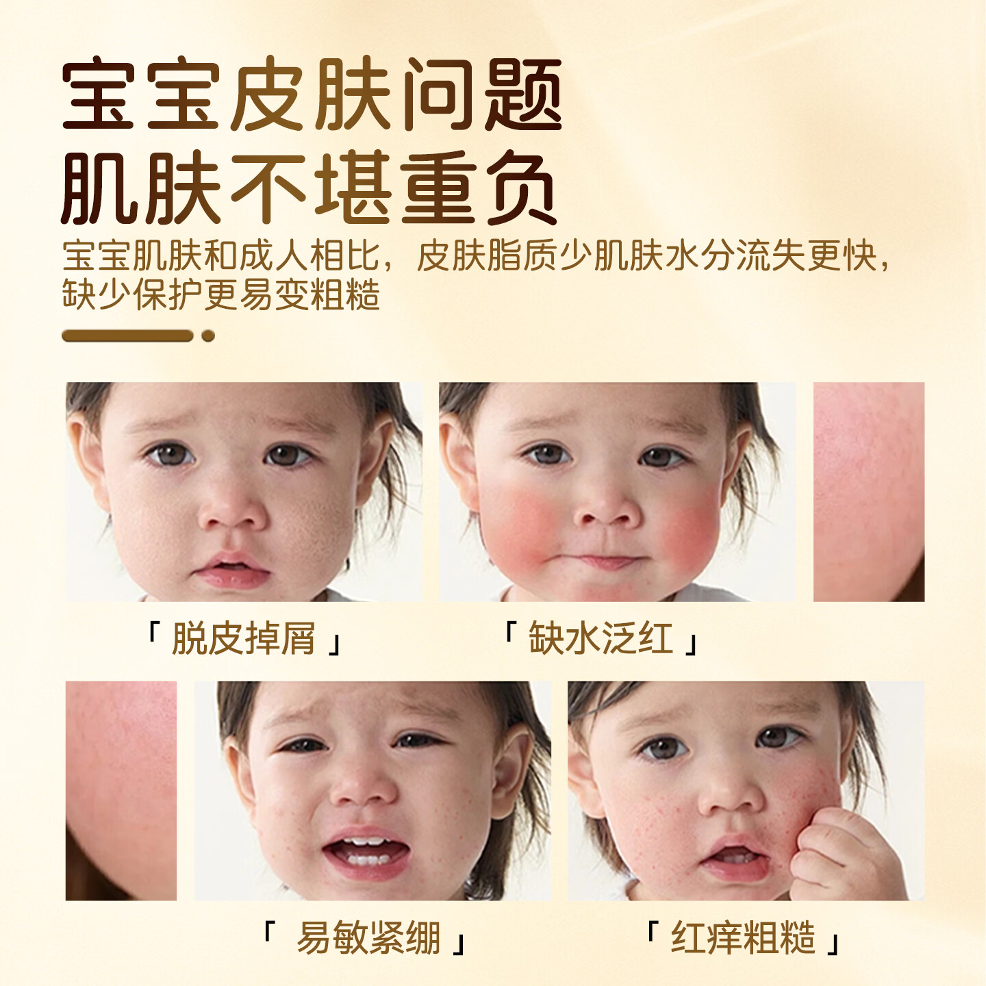 一泊萌金盏花保湿霜芦荟特霜身体乳擦脸四季可用面霜宝宝婴儿补水润肤霜 【宝宝优肌夏日乳】100m*1