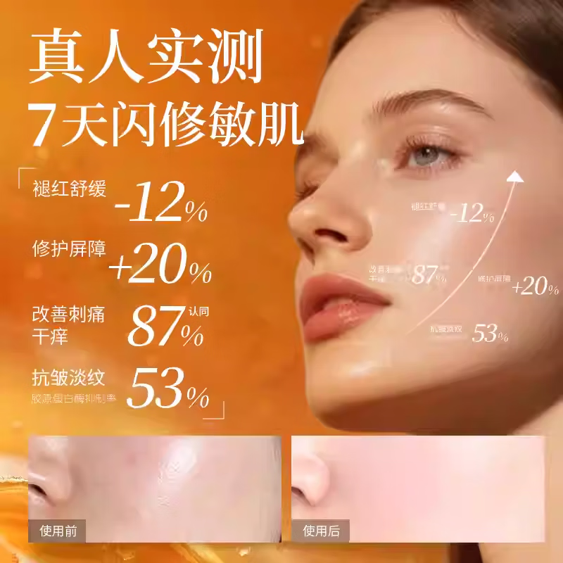 嘉媚乐角鲨烷精华油干皮抗皱舒缓修护补水保湿护肤油以油养肤 节日礼物 15ml