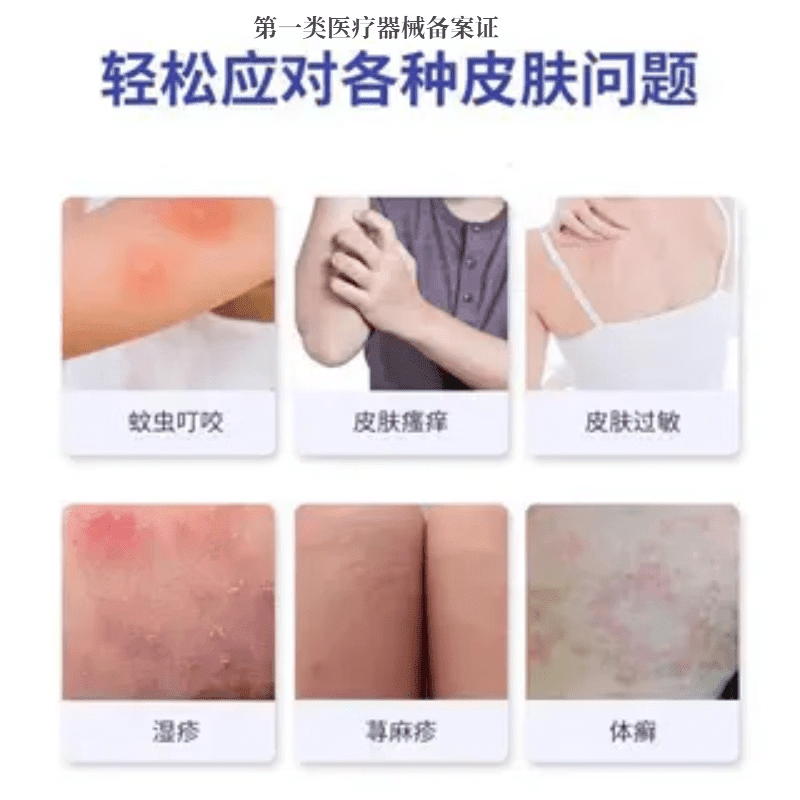 MRYU皮炎宁酊水正品外用皮肤膏止痒内蒙古大唐抑菌液脚蜕皮痒足部灵丁 3瓶【周期装】 官方直售