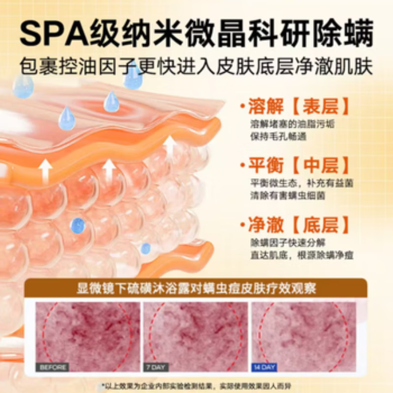 硫磺净满沐浴露硫磺温泉水控油除螨硫磺皂液祛痘清洁 硫磺净满沐浴露【三瓶疗程装】 除螨 祛痘 滋润 嫩肤