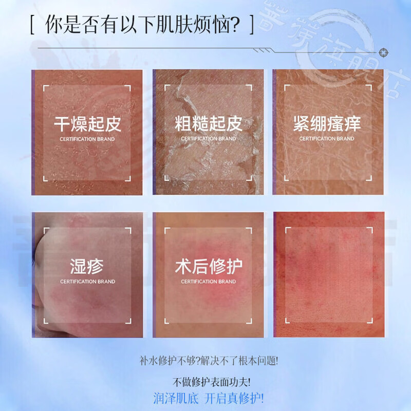 御妙春理雾季透明质酸钠医用透明质酸钠修复敷料凝胶袪痤疮痘印正品直售 3支【优惠装】