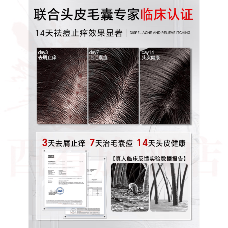 熏姿颜海文赫止痒柔顺洗发水二硫化硒去屑控油蓬松毛囊清洁头皮官方正品 2瓶【中症周期装】毛囊养护深度改善 官方自售