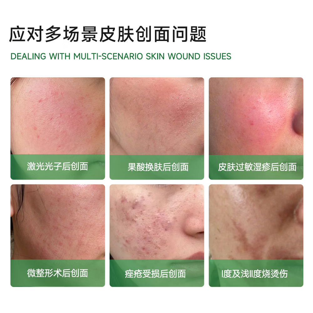 自然攻略医用重组胶原蛋白皮肤创面敷贴械字号医美术后护理激光光子绿膜 2盒装10片【拒绝肤感不适】