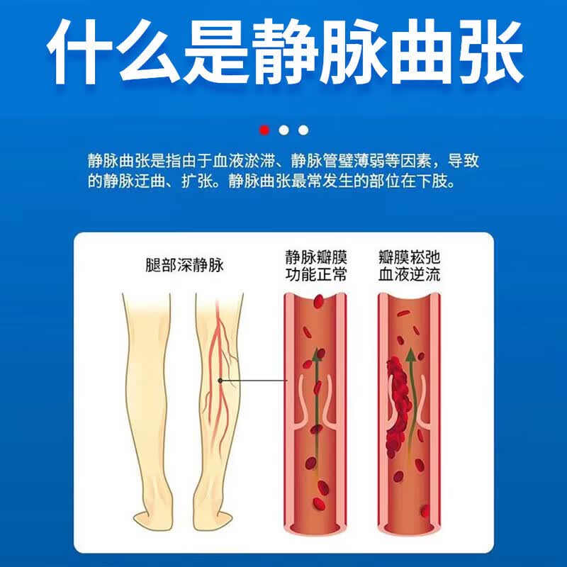 葵花腿上红血丝去除静脉曲张专用膏血管堵塞疏通药膏修复角质层腿上红 八盒【买5送3 多数顾客的选择】