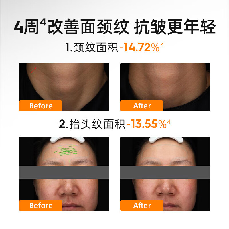 绽媄娅【活动款】紧致淡纹贴骨pro面霜 抗皱紧致滋养精华霜 紧致贴骨面霜15g*4