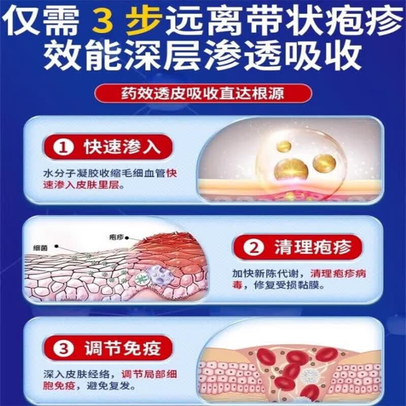 MRYU海澳司康舒元带状疱疹后遗神经痛症药蛇盘疮水痘性疱疹蜘蛛疮正品 5盒装 买三赠二【巩固装】96%用户选择 【官方直售 京质保障】