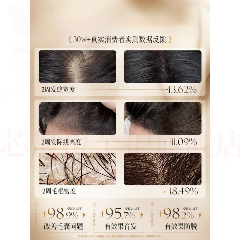 思亚希金米茜洗发水何首乌控油去屑减少掉发防脱固发滋养发根改善顺发质 5瓶装【重度脱发必选】 官方直售