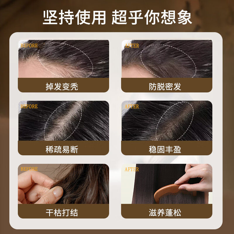 同仁堂（TRT）何首乌生姜洗发水防脱育发养发密发黑灵芝滋养白头发转养黑治发根  1瓶装防脱新体验【建议按以上套餐选择】