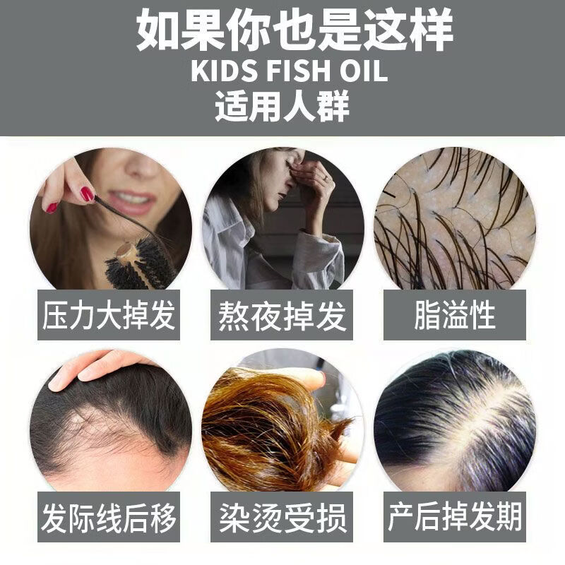 Swisse澳洲女士养发胶囊60粒维生素B防脱护发片营养头发 【女士生发胶囊】60粒 1mg*1罐