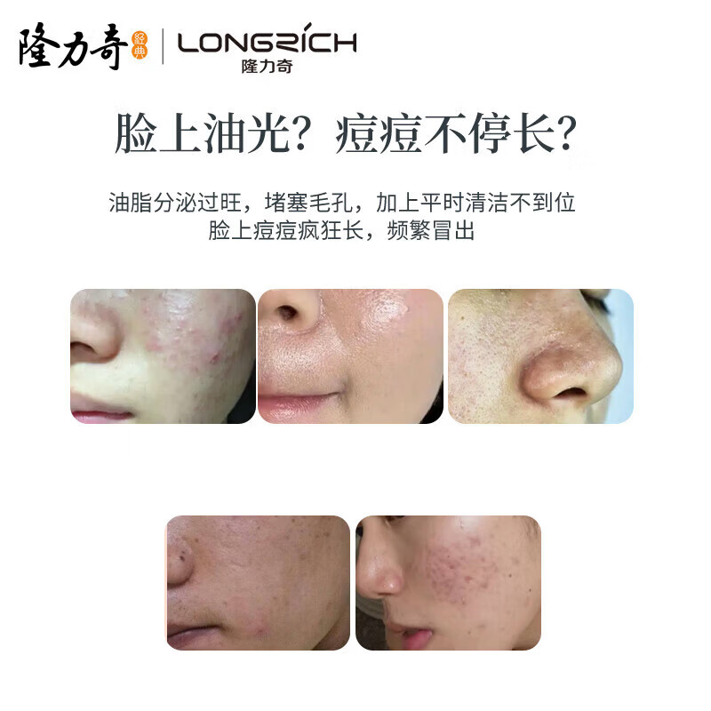 隆力奇硫磺控油洁颜泥氨基酸多效硫磺洗面奶祛痘卸妆舒缓肌肤 一支 100ml