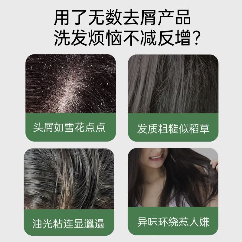 Spes诗裴丝二硫化硒洗发水持久控油蓬松去屑止痒洗发水男女适用 【第二瓶半价】二硫化硒洗发水380ml*2瓶