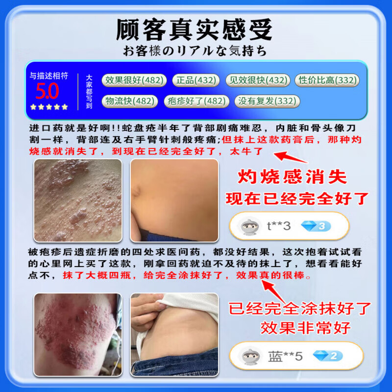 MRYU海澳司康舒元带状疱疹后遗神经痛症药蛇盘疮水痘性疱疹蜘蛛疮正品 5盒装 买三赠二【巩固装】96%用户选择 【官方直售 京质保障】