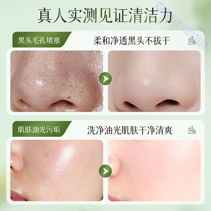 鹿角卉妈妈说洗面奶洁面慕斯舒缓清润控油祛痘去黑头收缩毛孔净澈水润 5支 清爽控油 不拔干 官方直售