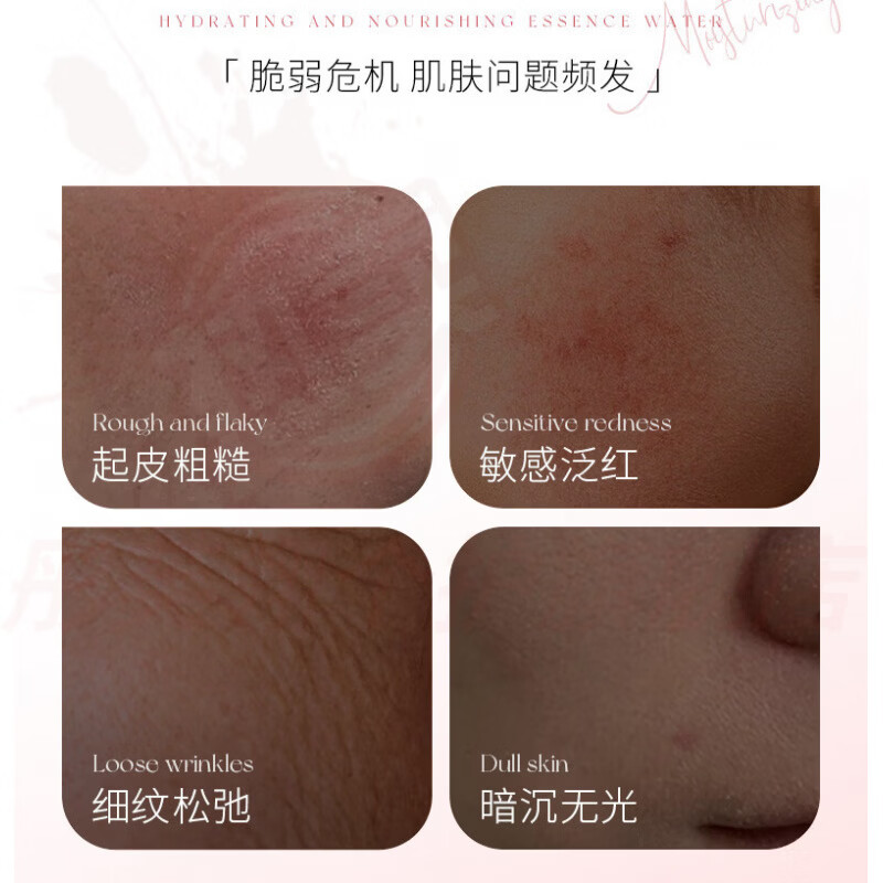 熏姿颜伊丽莎白湿敷水精华水淡纹紧致抗皱抗氧提亮去黄改善暗沉酵母舒润 1瓶【见效装】抚纹抗皱 官方自售