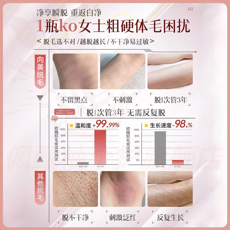 MRYU威诗薇儿脱毛膏腋毛手腿毛全身无痛除体毛温和不刺激光滑丝滑细腻 五支装 官方自售