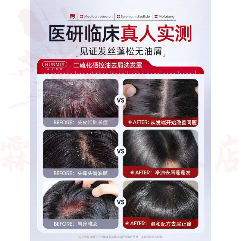 思亚希爱茉博士去屑洗发水二硫化硒控油蓬松止痒毛囊清洁舒痒柔顺丰盈净 白瓶+米色瓶*2 官方直售