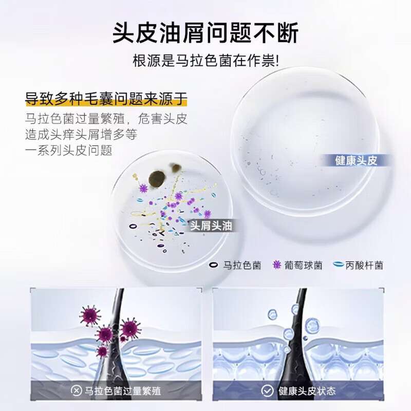 BEIYVS爱茉博士去屑洗发水二硫化硒清屑止痒控油蓬松持久留香清洁头皮 3瓶【长期修护 头屑0反复】 【官方直售 京质保障】