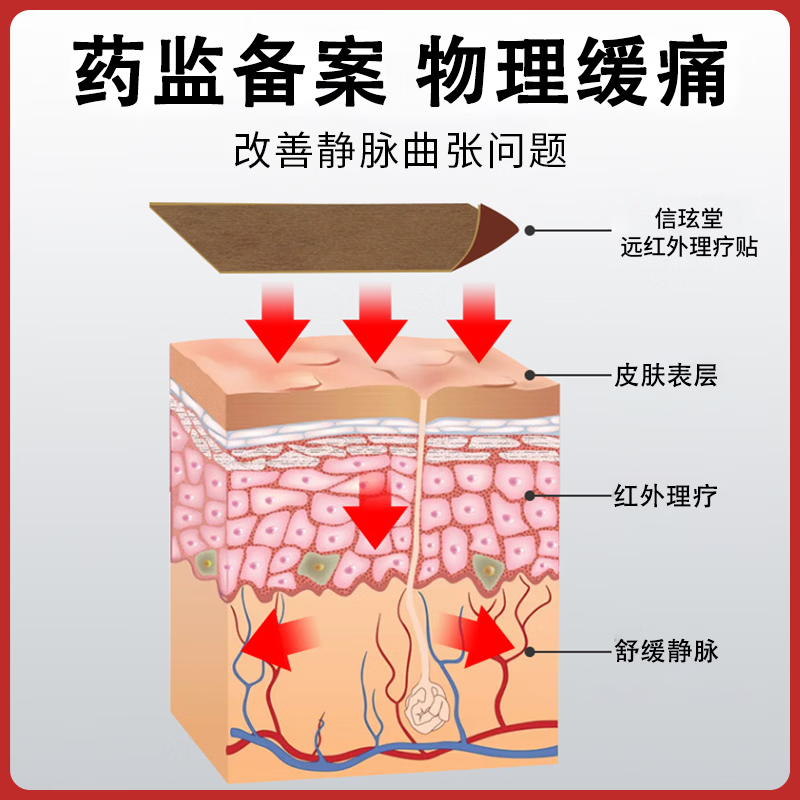 信玹堂静脉曲张远红外理疗贴蚯蚓腿红血丝腿部肿胀官方正品现货速发 3盒【周期装】青筋凸起腿部血丝