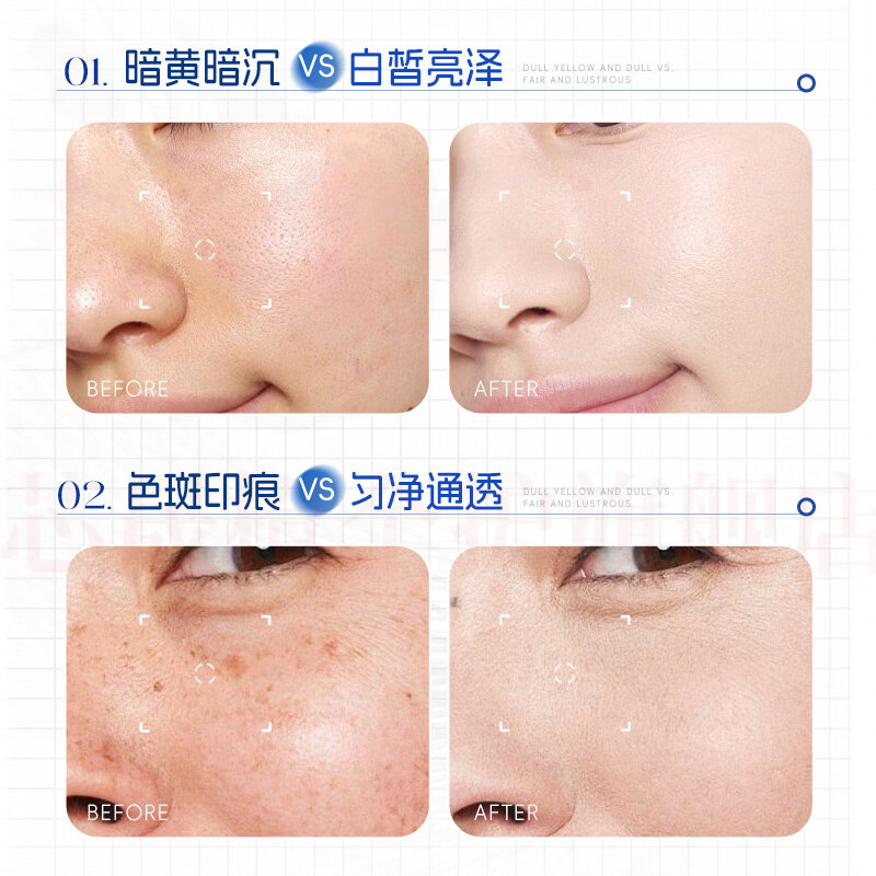 思亚希雅慕泉祛斑霜精华淡化黑色素去斑黄褐斑雀斑晒斑提亮肤色改善暗沉 5瓶 囤货装 官方直售