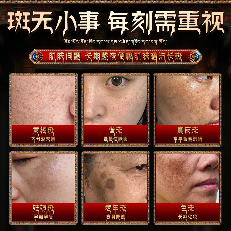 宇妥元丹贡布祛斑胶囊古方淡斑内调祛黄褐斑美白淡斑淡化黑色素 祛斑胶囊 6g*5盒 【巩固装80%人选择】