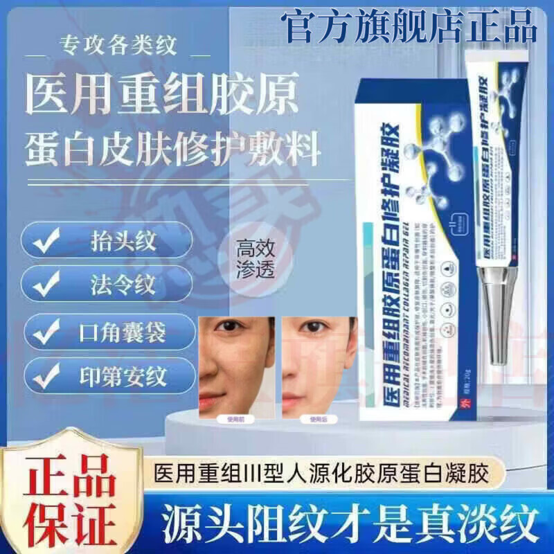 MRYU舒活宜凝胶祛法令纹颈纹医用硅酮凝胶提拉修护紧致肌肤官方旗舰店 3支装 官方自售