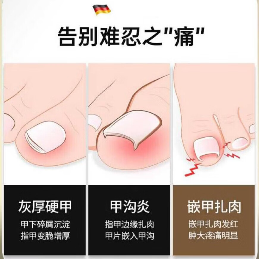 FIELL【德国】指甲刀套装全套原装高端指甲钳灰指甲专用指甲剪修甲工具 【高奢绿】指甲剪专业11件套+修脚3件套 【居家必备 工具齐全 满足日常所需】