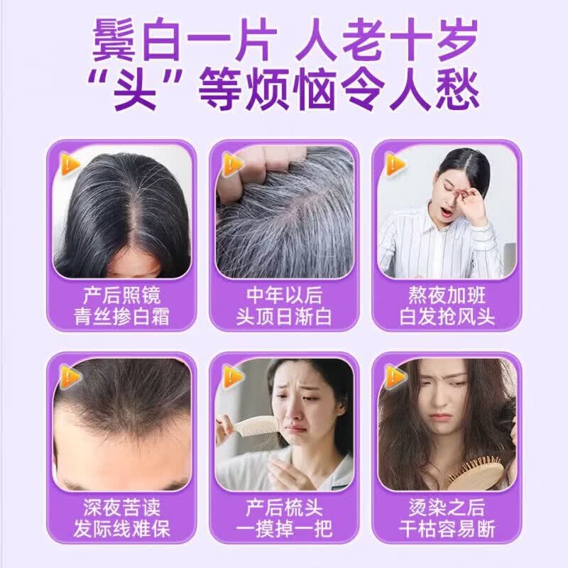 DWDS【官方正品】卡西耐卡西奈维生素B卡西奈鱼油白发调理精华乌黑素 官方正品【巩固装】 60片*3盒 京东官方大药房