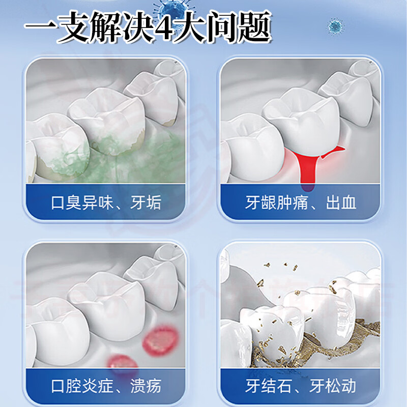 鹿角卉俊小白牙龈i萎缩护理牙膏脱敏牙周i炎减轻牙龈敏感去渍护龈固齿亮 5支装【长效护龈再生】 官方自售