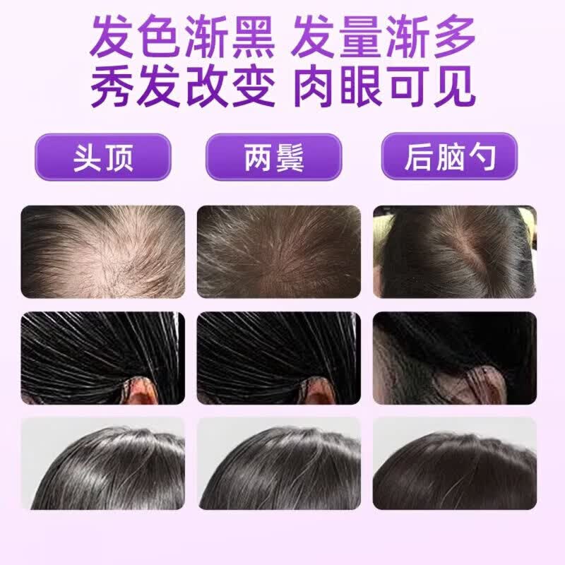 DWDS【官方正品】卡西耐卡西奈维生素B卡西奈鱼油白发调理精华乌黑素 官方正品【巩固装】 60片*3盒 京东官方大药房