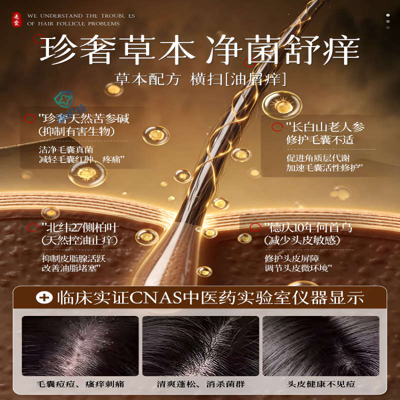 卓医师苦参碱洗发水pca锌去屑止痒控油蓬松 3瓶装