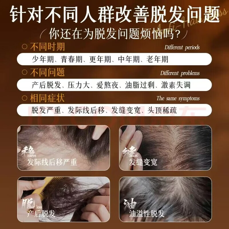 同仁堂（TRT）何首乌生姜洗发水防脱育发养发密发黑灵芝滋养白头发转养黑治发根  1瓶装防脱新体验【建议按以上套餐选择】