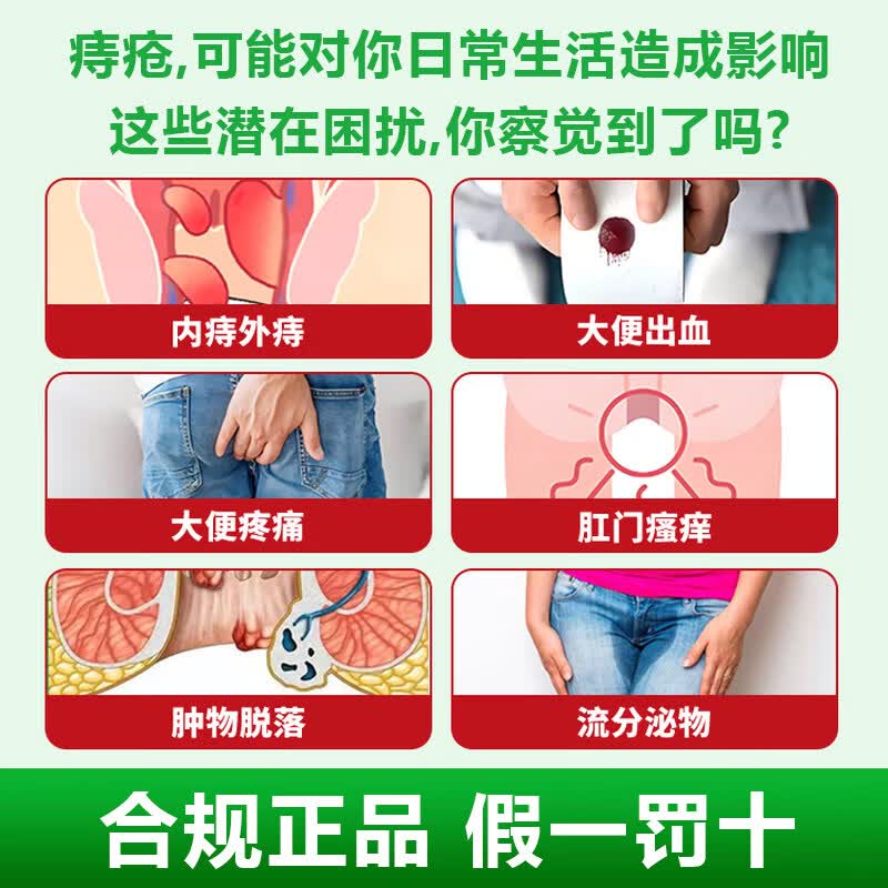 敖东痔疮凝胶内痔外痔混合痔肛门坠胀痛 [两盒周期装】轻度/早期疼痛瘙痒