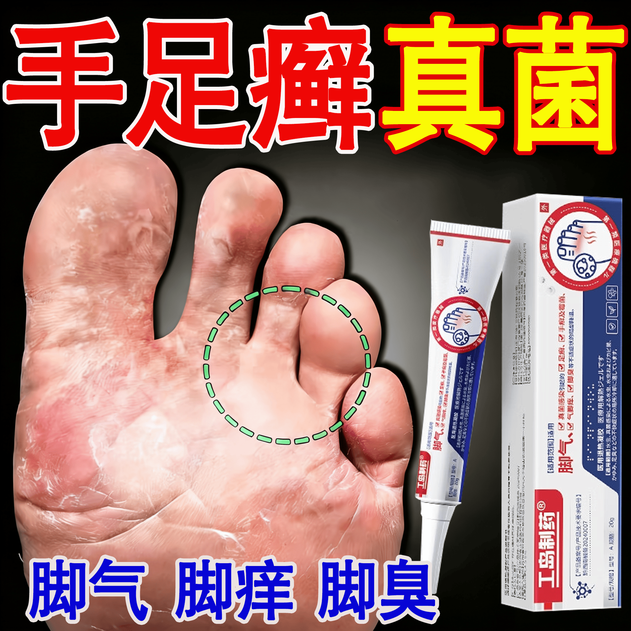 工岛制药日本脚气止痒脱皮烂脚丫去真菌王感染治水泡脚痒出汗脚臭根狼除毒