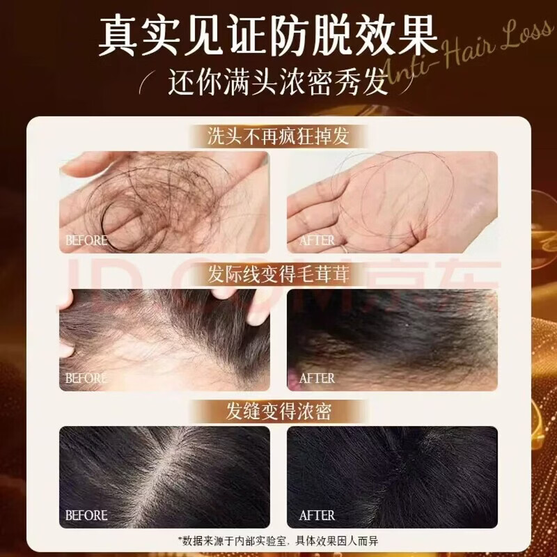 同仁堂（TRT）何首乌生姜洗发水防脱育发养发密发黑灵芝滋养白头发转养黑治发根  1瓶装防脱新体验【建议按以上套餐选择】