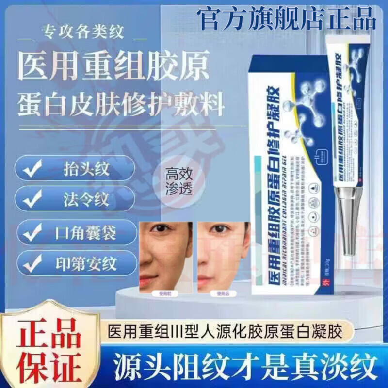 MRYU舒活宜凝胶祛法令纹颈纹提拉修护抗皱紧致肌肤医用硅酮官方旗舰店 5支装 官方自售