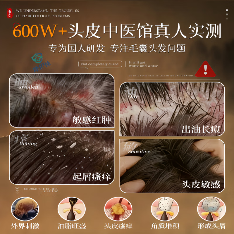 卓医师苦参碱洗发水pca锌去屑止痒控油蓬松 3瓶装