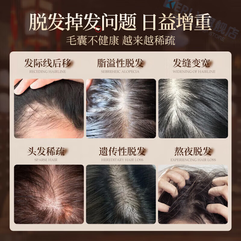 熏姿颜梦可恋防脱洗发水侧柏叶去屑止痒控油蓬松柔顺滋养发质强韧 5瓶【重现浓密秀发 自信闪耀】 【官方直售】