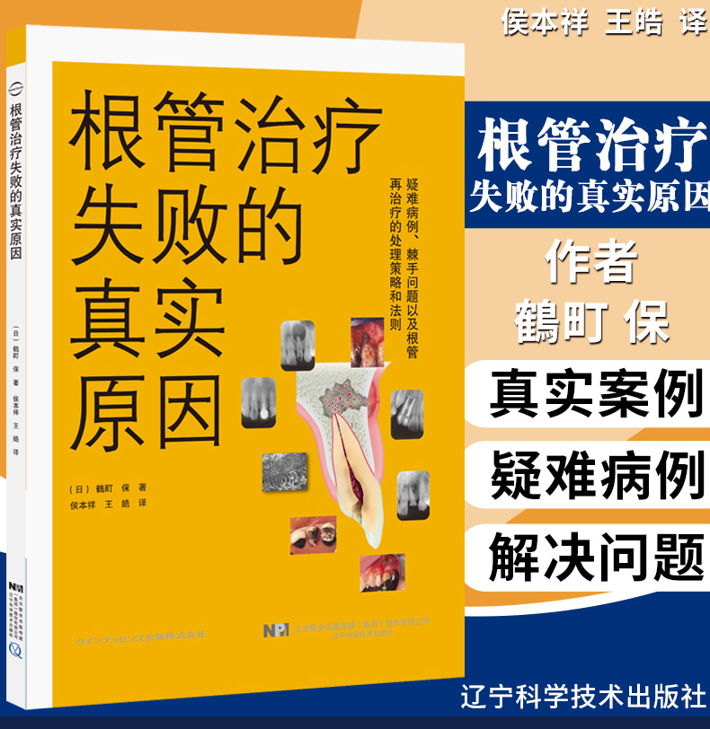 根管治疗失败的真实原因 日鶴町保著侯本祥王皓译 口腔修复正畸种植学医学类专业书籍图谱牙体牙髓病真正根尖周病变辽宁科技出版社
