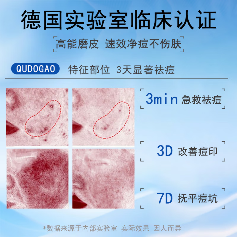 梦若羽eak祛痘凝胶【官方直售】淡化痘印去豆痘坑闭口粉刺青春痘痘黑头 【99%的顾客选择】买三赠二 5支装 【官方旗舰 京质保障】