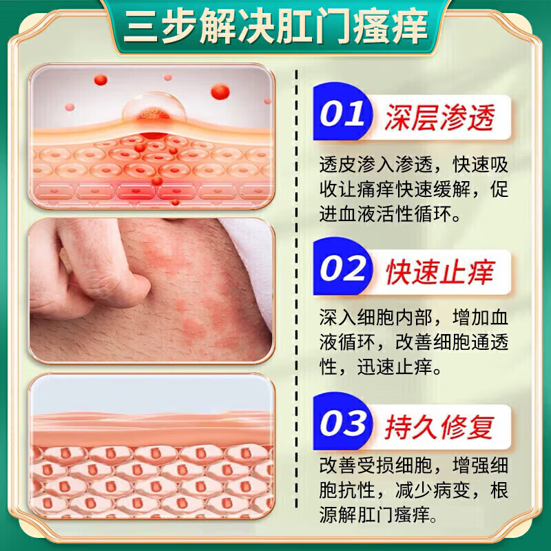 肛门瘙痒止痒专用的药膏屁股痒肛周潮湿100%止痒膏肛周湿正品疹 特效:1盒装【日本进口】