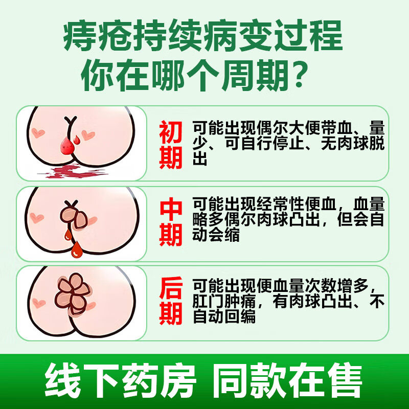敖东痔疮凝胶内痔外痔混合痔肛门坠胀痛 [两盒周期装】轻度/早期疼痛瘙痒