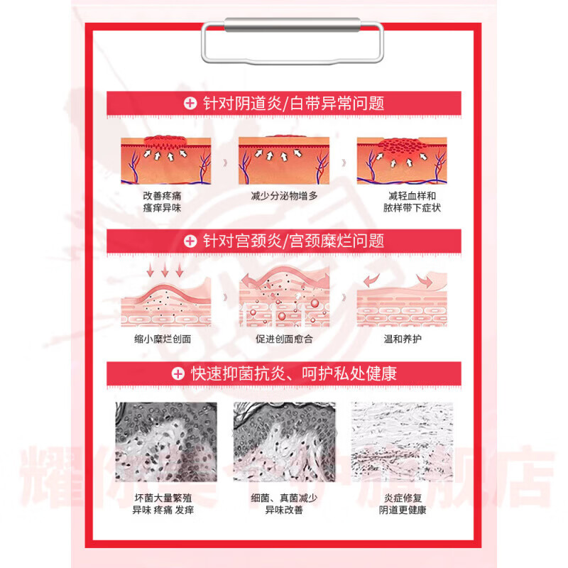 鹿角卉添魅一指凝胶宫颈炎分泌物增多脓样带下炎瘙痒鱼腥味医用妇科 5盒装【重度反复症状】 官方直售