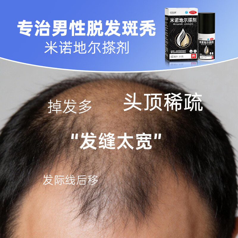 [恒医森]米诺地尔搽剂 60ml*1瓶 2盒装 60ml/瓶 5% 生发液男用宽发缝防脱生发发际线脱发斑秃泡沫米洛地尔正品 固发装