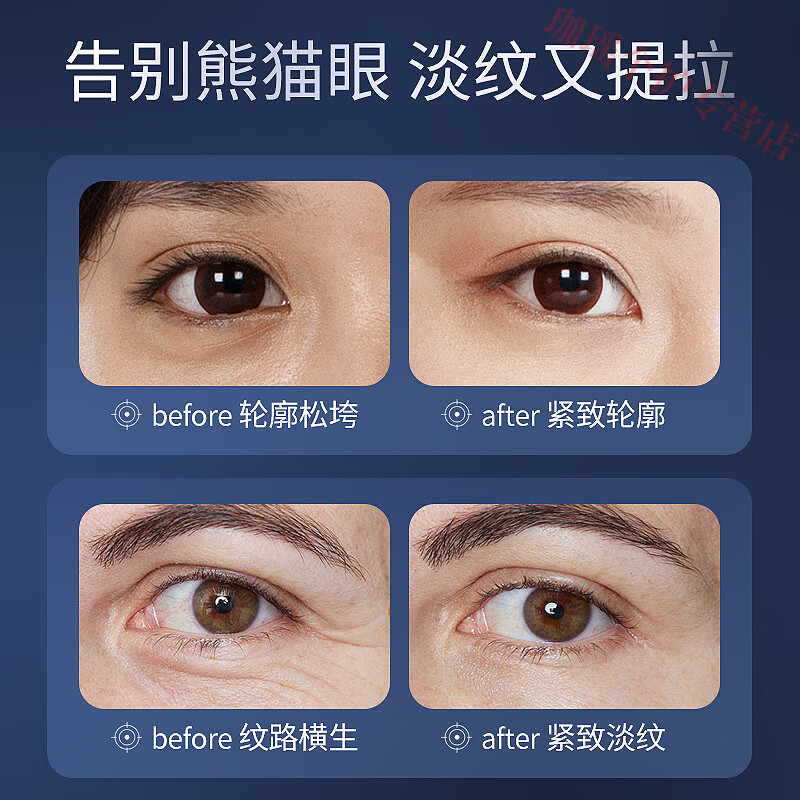 熏姿颜美望眼霜抗皱紧致抗衰老淡化黑眼圈细纹提拉眼袋官方旗舰店正品 1瓶 官方自售